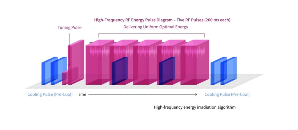 High-frequency RF energy pulse diagram showing sequential pulses with pre-cooling and tuning phases