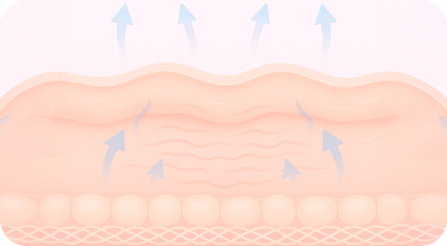 Skin layer illustration with upward arrows indicating lifting and tightening effect