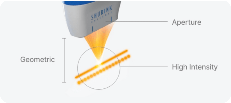 HIFU handpiece emitting focused ultrasound with geometric high-intensity energy lines